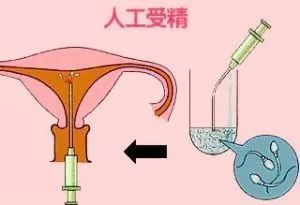 泰国试管婴儿