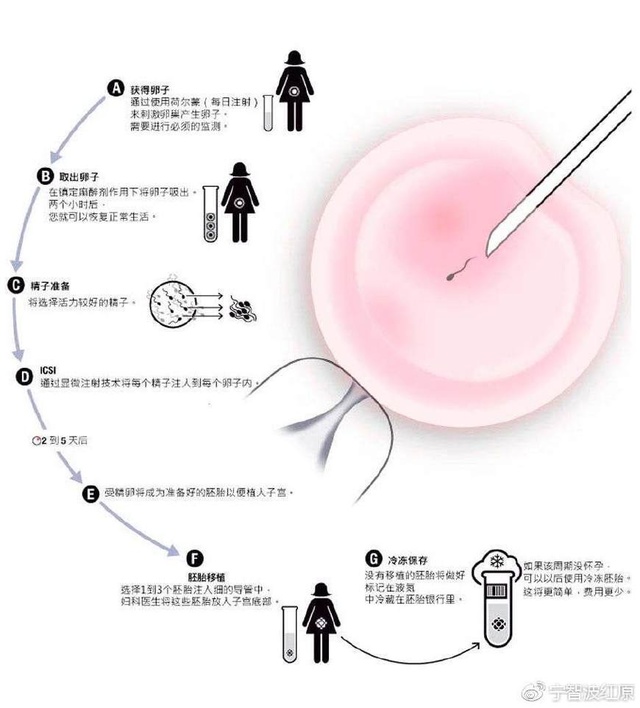沈阳不孕不育医院