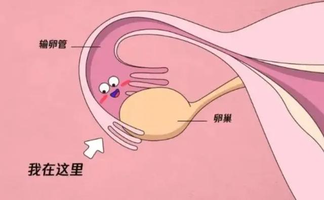沈阳助孕
