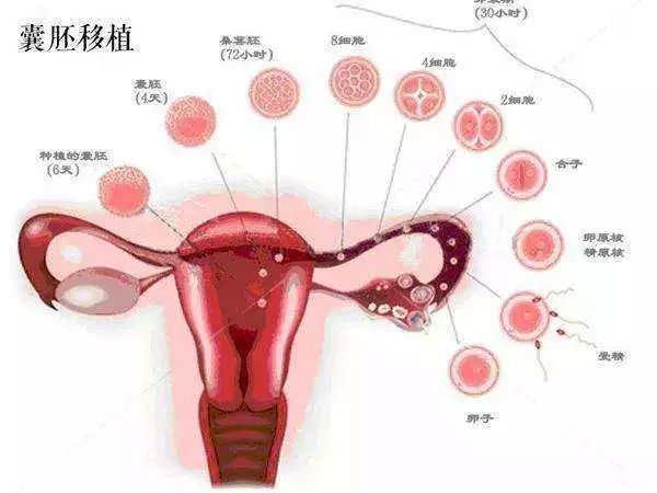 泰国试管婴儿