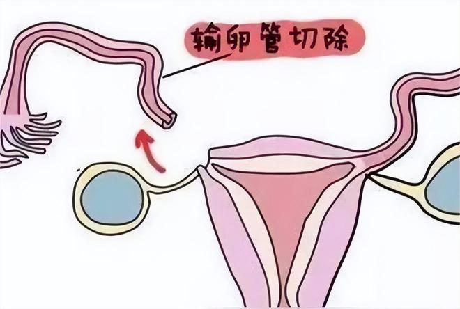 河南试管婴儿