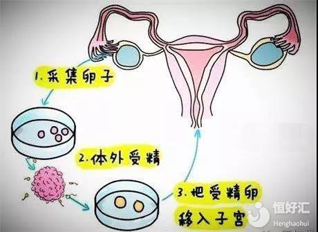 河南试管婴儿医院