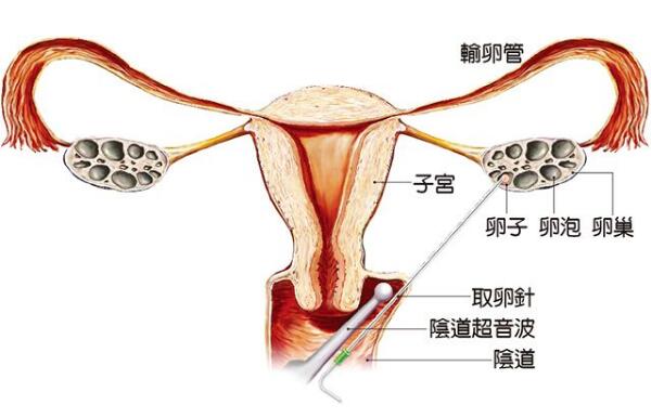 重庆催收公司排名